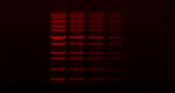 Sistema de imágenes de electroforesis